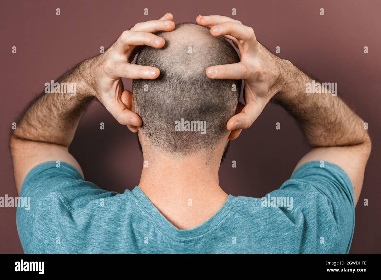 Baldy man grabs his head with his hands. Rear view. Brown background. The concept of alopecia and baldness. Stock Photo