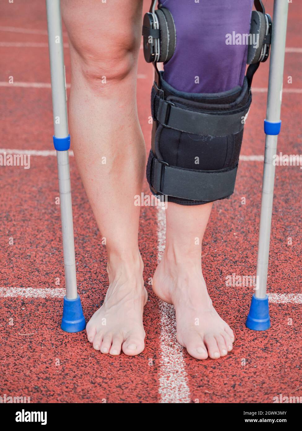 Woman suffering with walk by sticks and knee brace support surgery left knee in recovery time