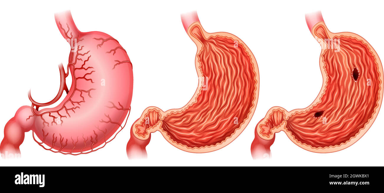 Stomach Stock Vector