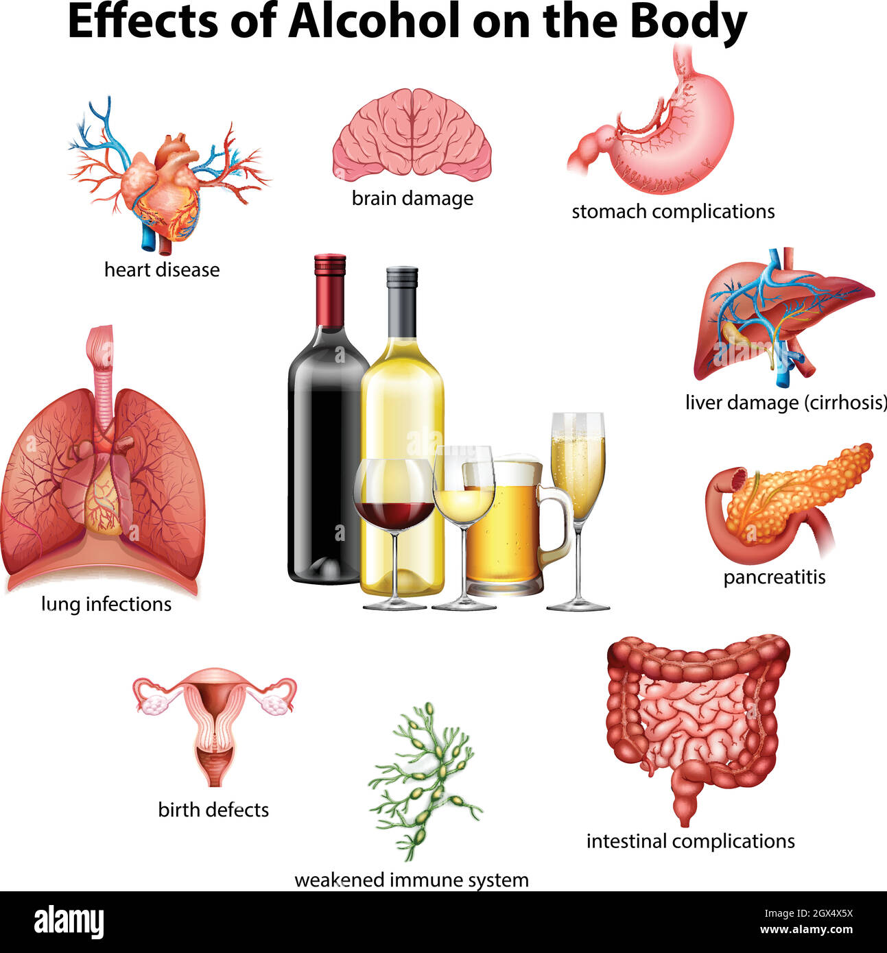 Effects of alcohol on the body Stock Vector
