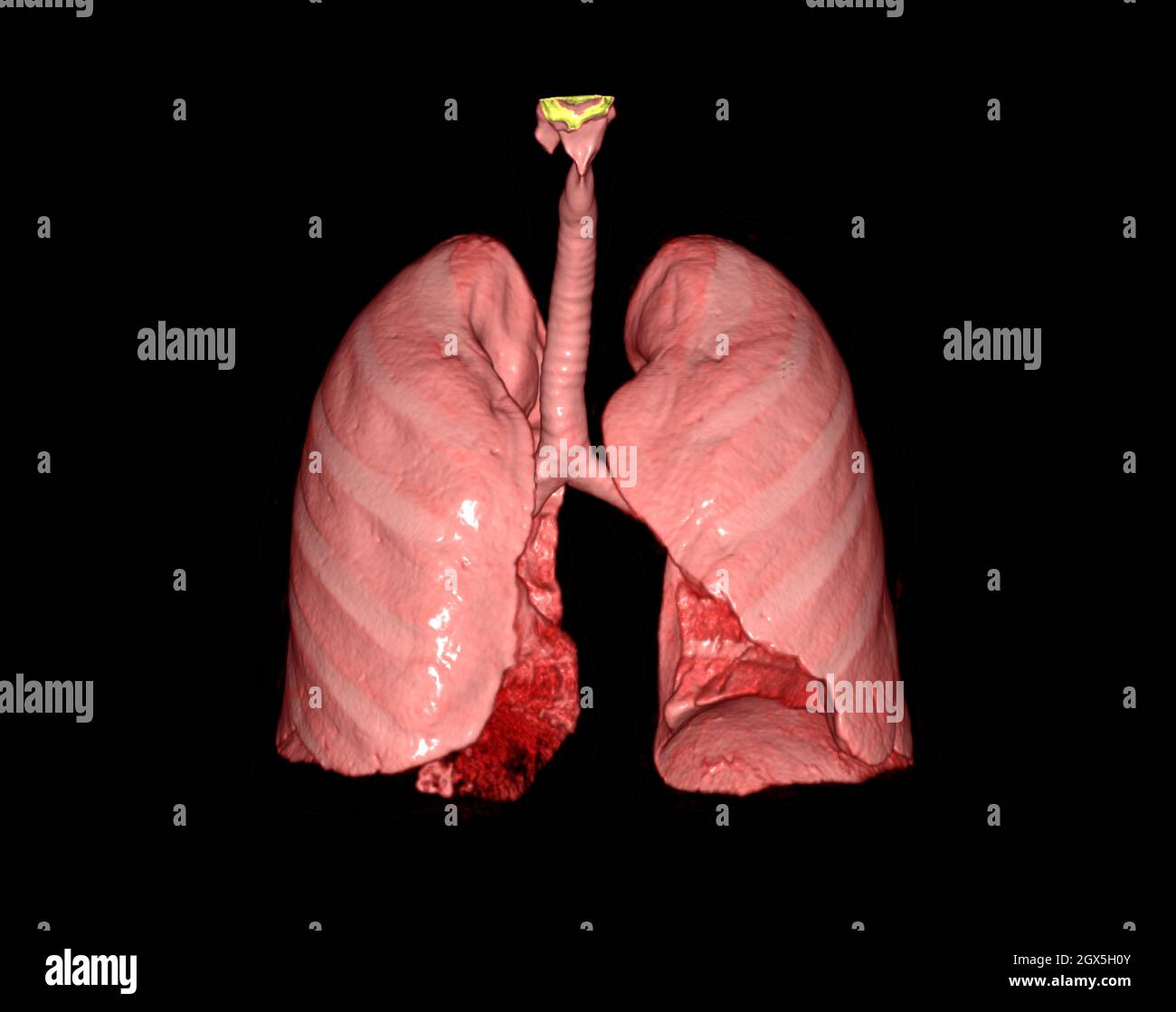 3d renderings of human lung showing respiratory system. Stock Photo