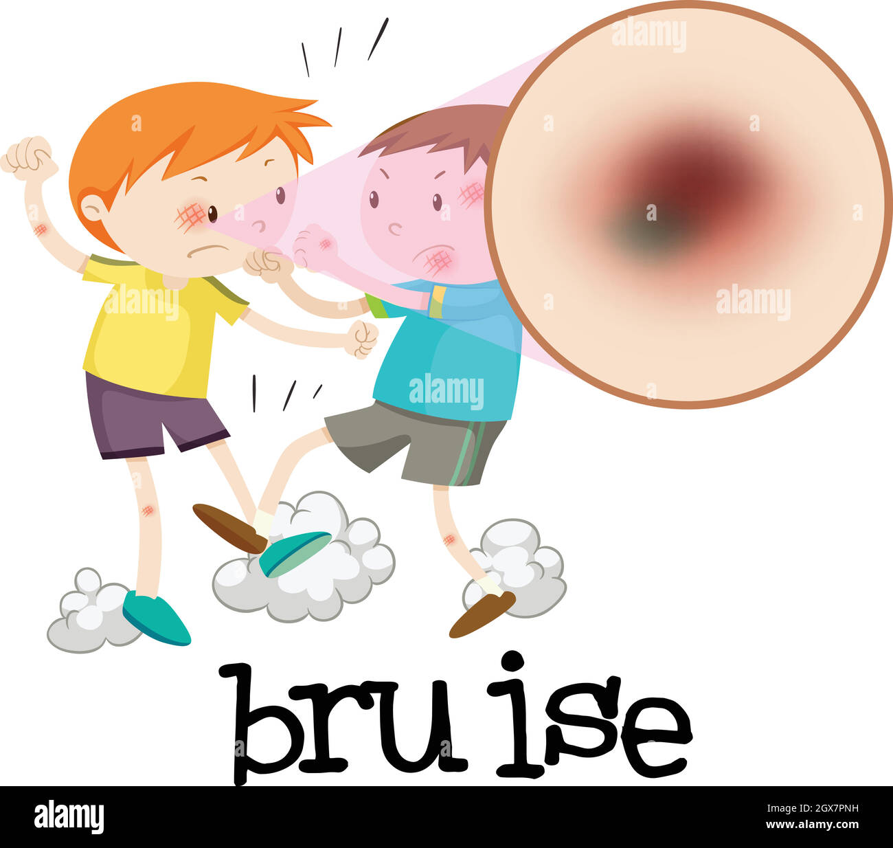 Boys Fighting and Having Bruise Stock Vector