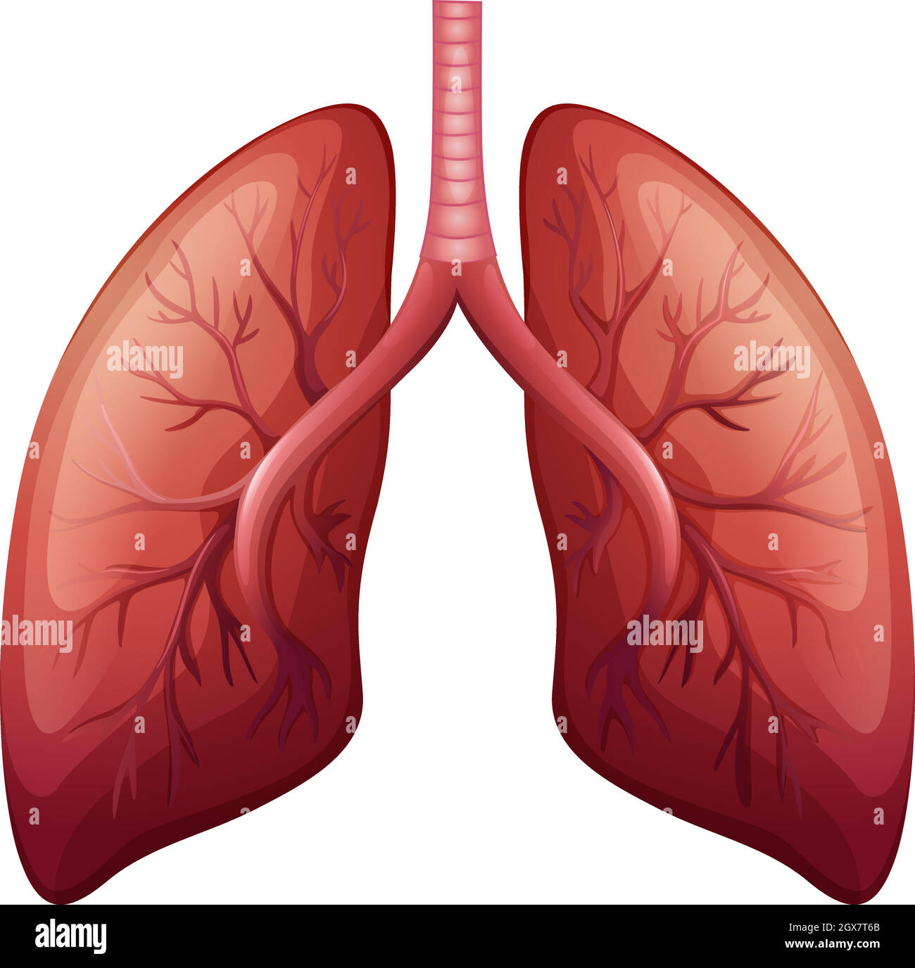 Lung cancer diagram in detail Stock Vector