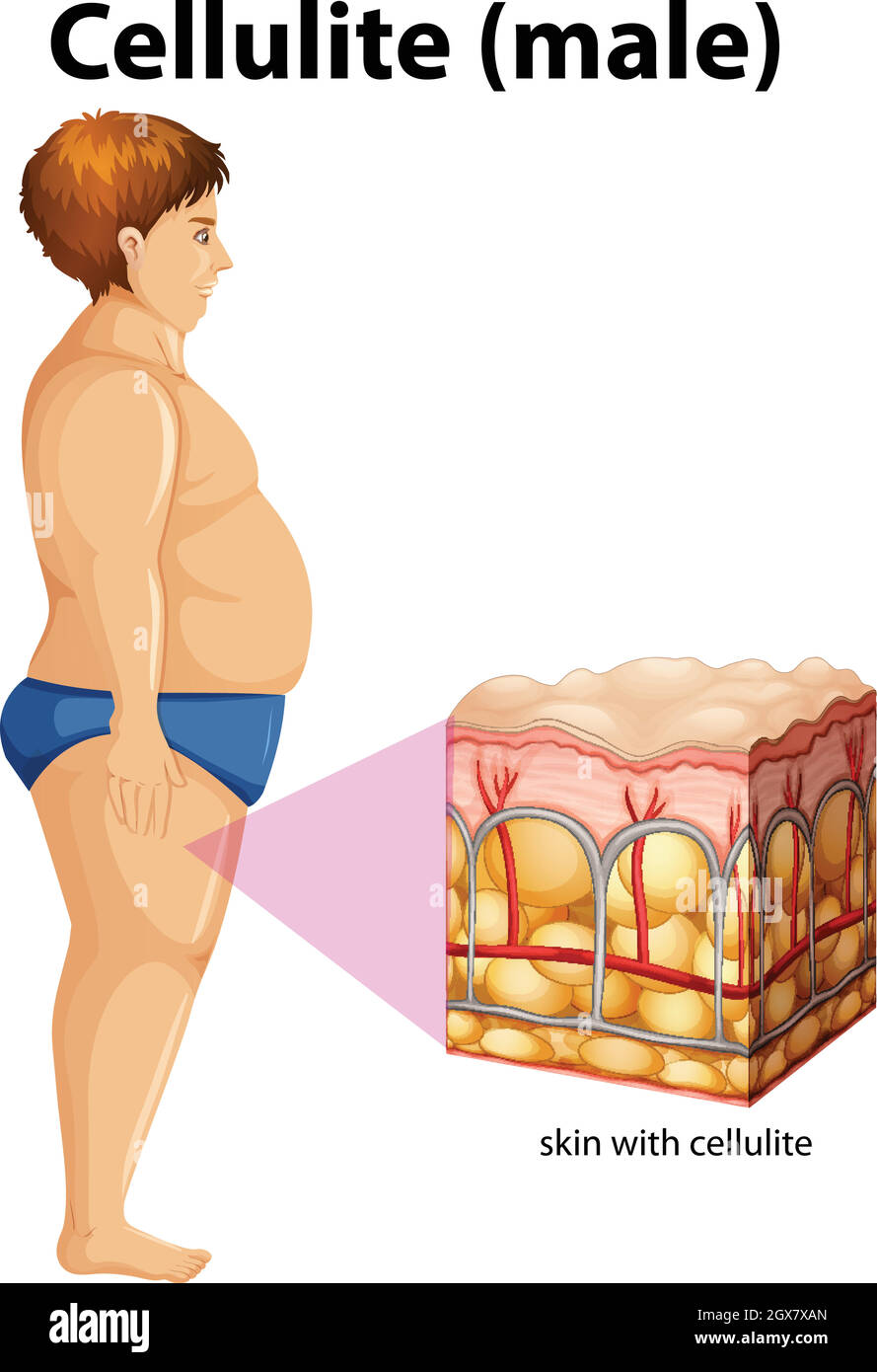 A fat man with cellulite Stock Vector