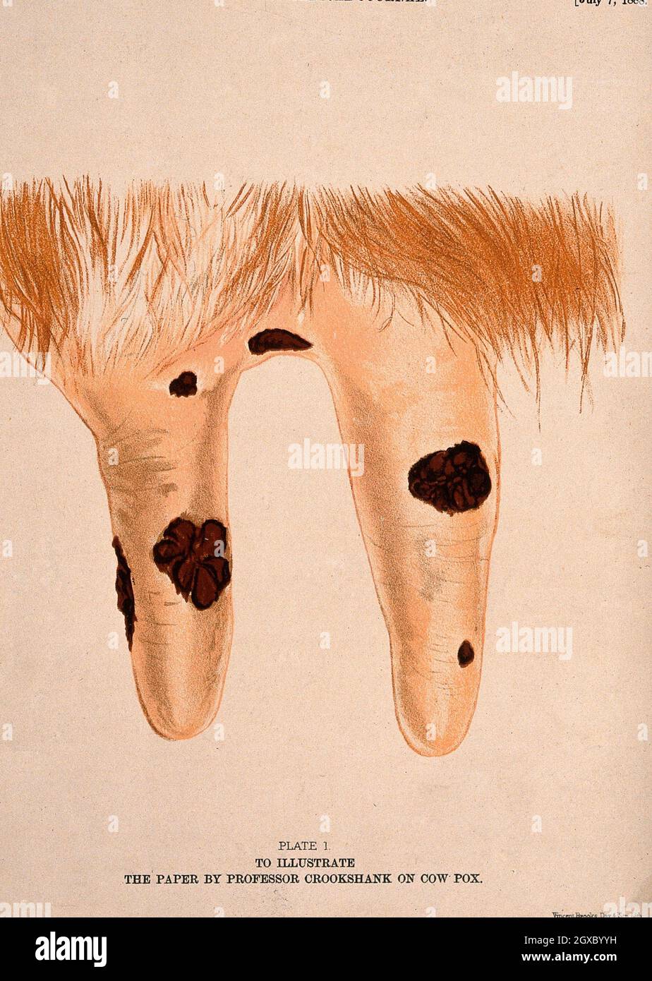 A cow's udder with vaccinia pustules. Chromolithograph. - Lettering Plate 1. To illustrate the paper by Professor Crookshank on cow pox. Stock Photo