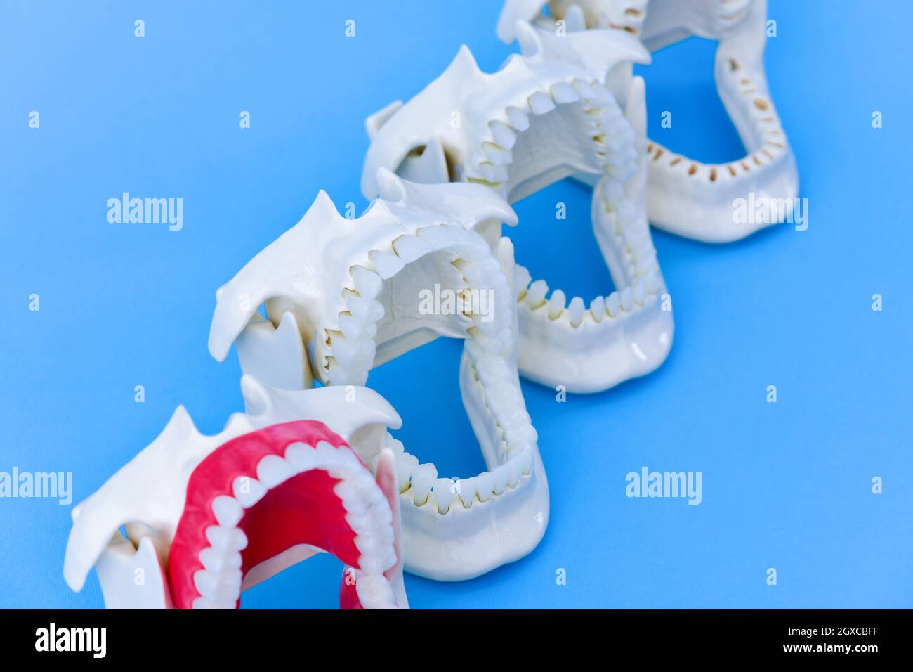 Dentist orthodontic teeth models with jaws opened on blue background