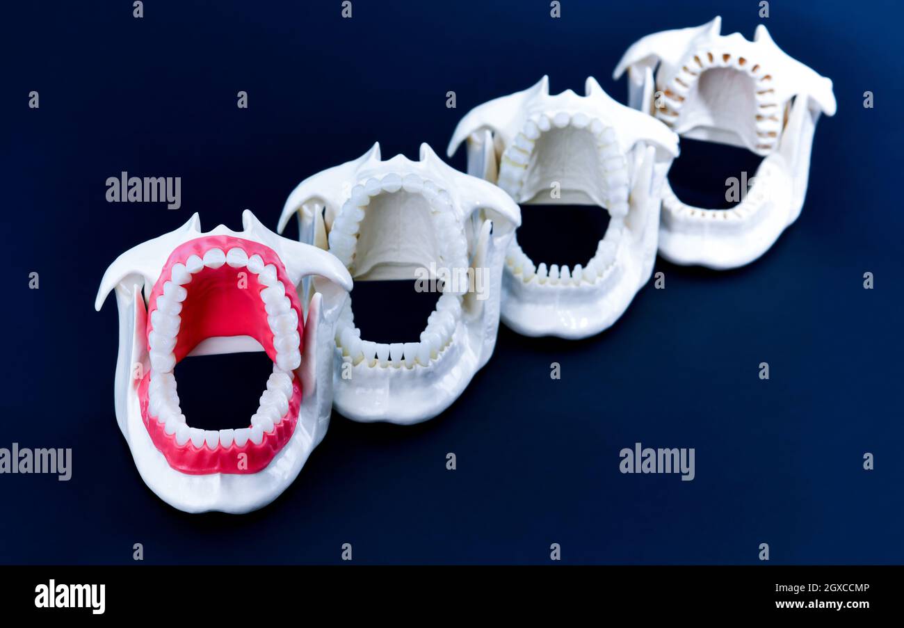 Dentist orthodontic teeth models with jaws opened on blue background ...
