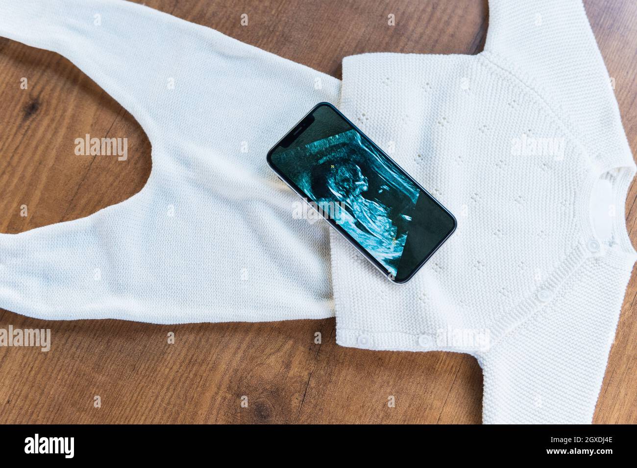 From above of cellphone with image of baby ultrasound placed on child outfit as concept of pregnancy Stock Photo