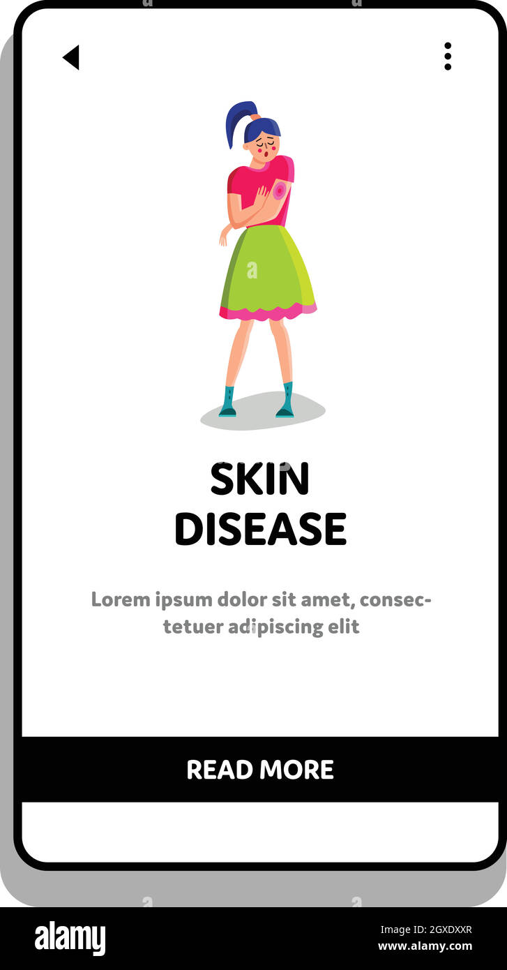 Dermatology Skin Disease Young Woman Hand Vector Stock Vector