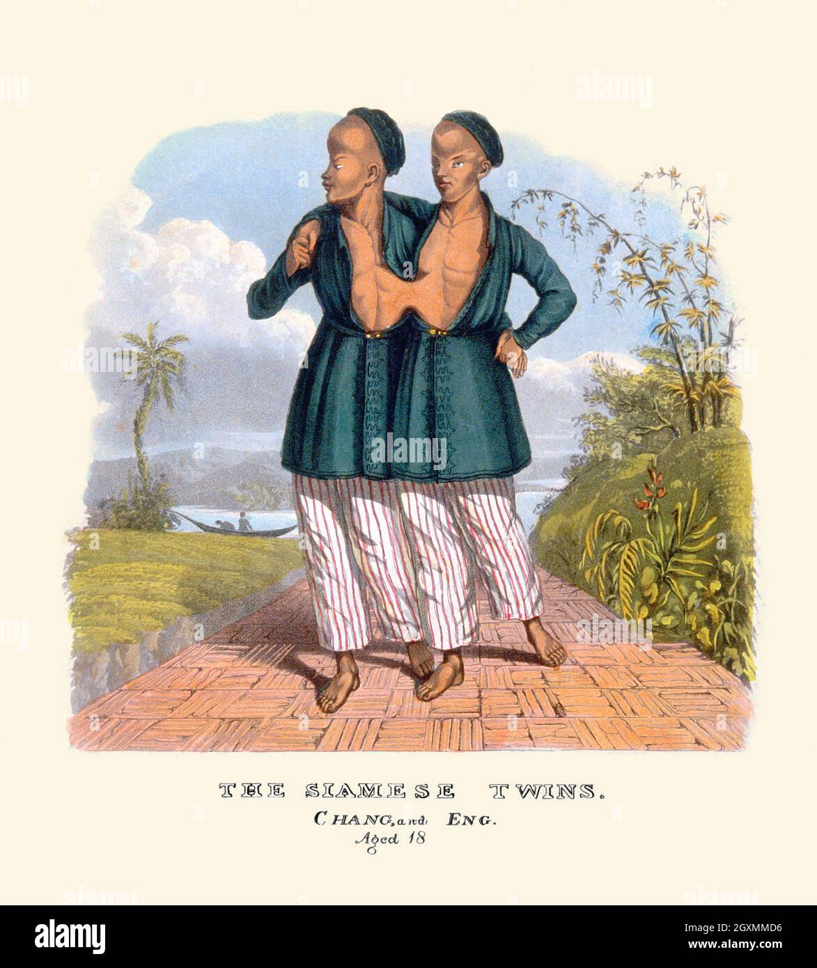 The Siamese Twins, Chang and Eng, age 18 Stock Photo