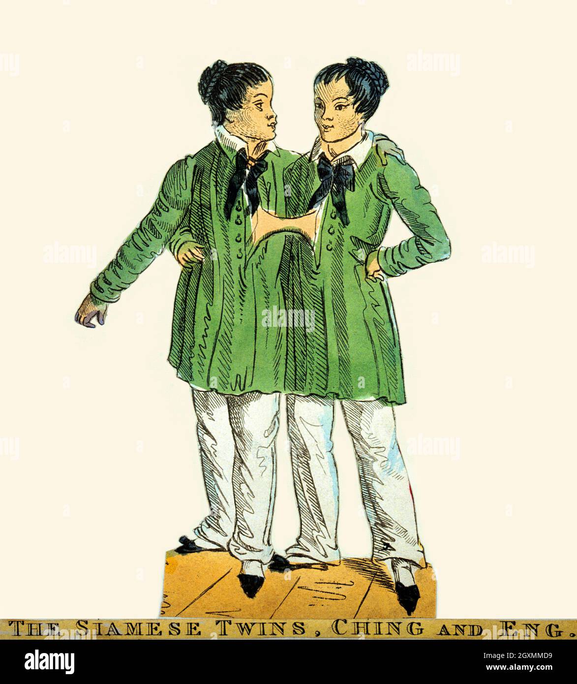 The Siamese Twins, Chang and Eng Stock Photo
