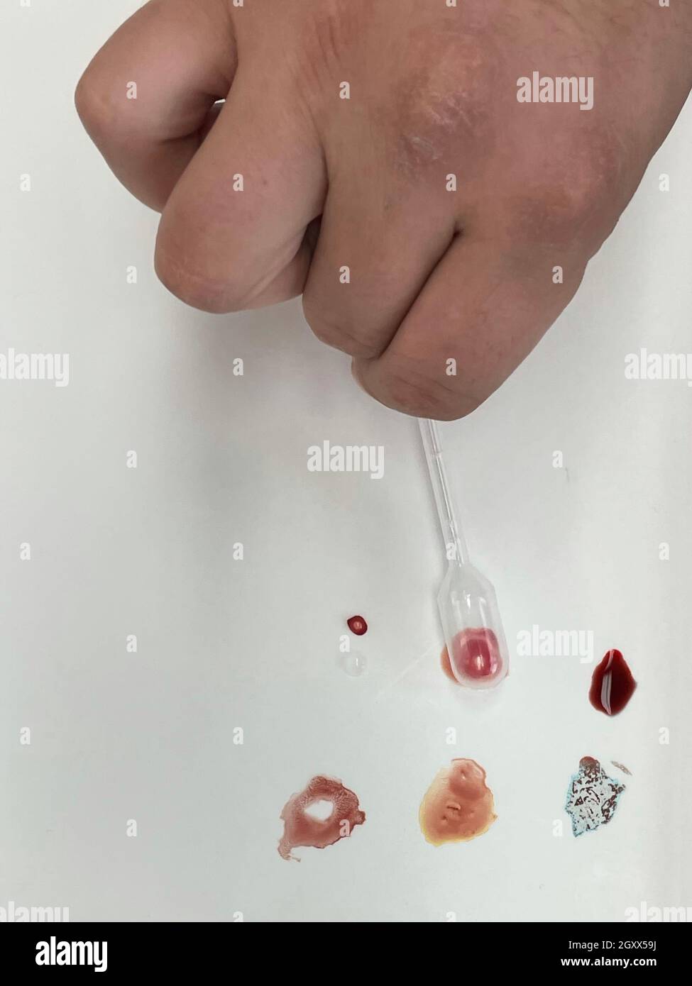 Medical doctor performing a quick blood group determination by using