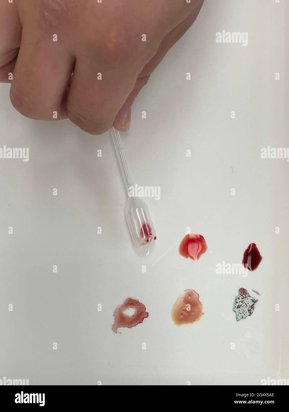 Medical doctor performing a quick blood group determination by using