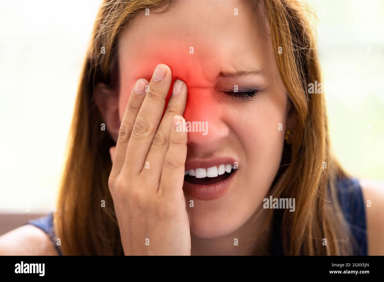 Eye Pain. Tired Young Woman Eyesight Stock Photo Alamy