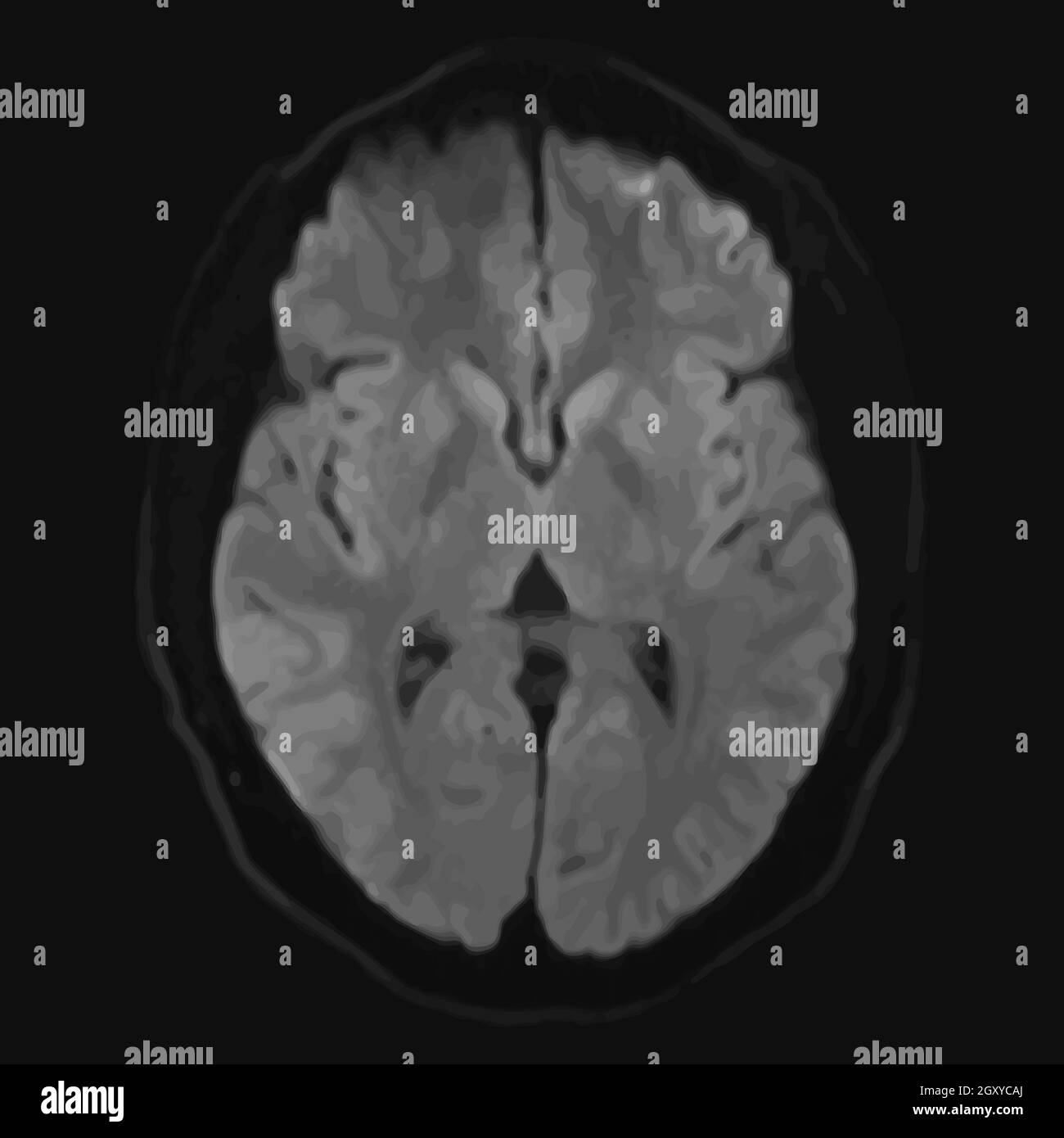 Realistic axial image of male cerebrum with CT scan, MRI Magnetic resonance imaging layer of brain. Isolated on dark background. Vector illustration. Stock Vector