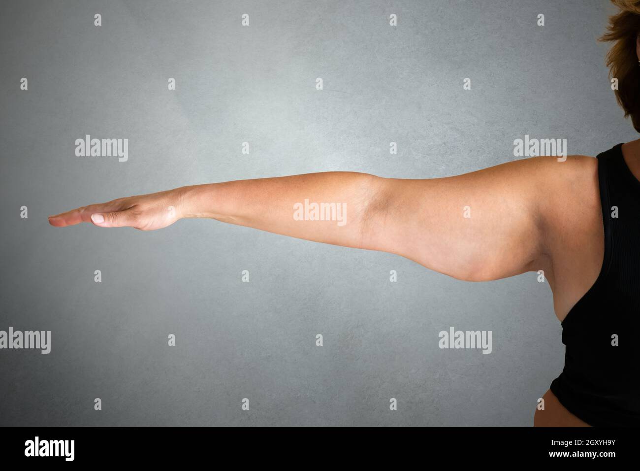 Overweight Lady Arm With Excess Fat. People Obesity Stock Photo Alamy