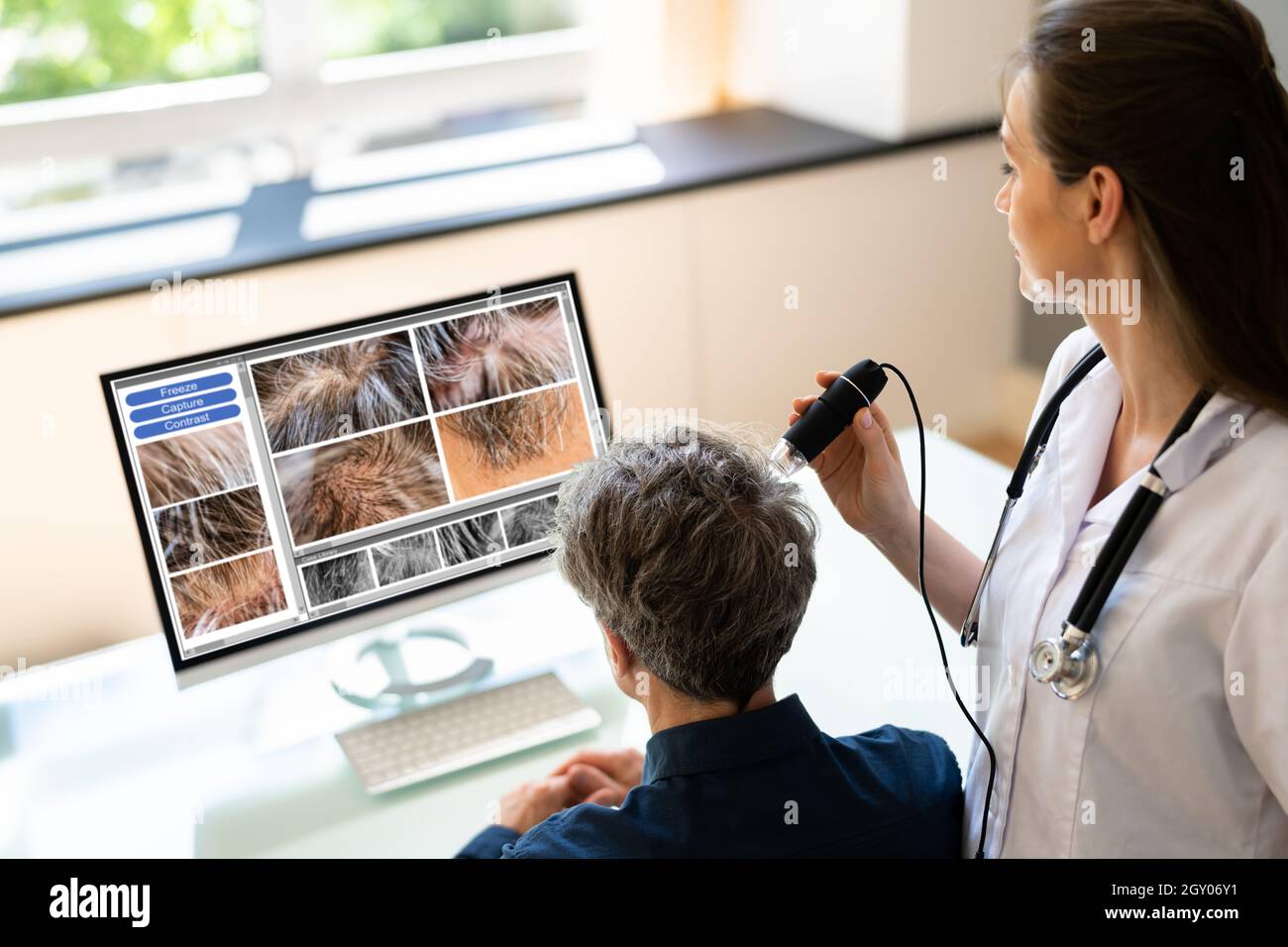Hair Scalp Analysis In Clinic. Man With Hair Fall And Dandruff Stock