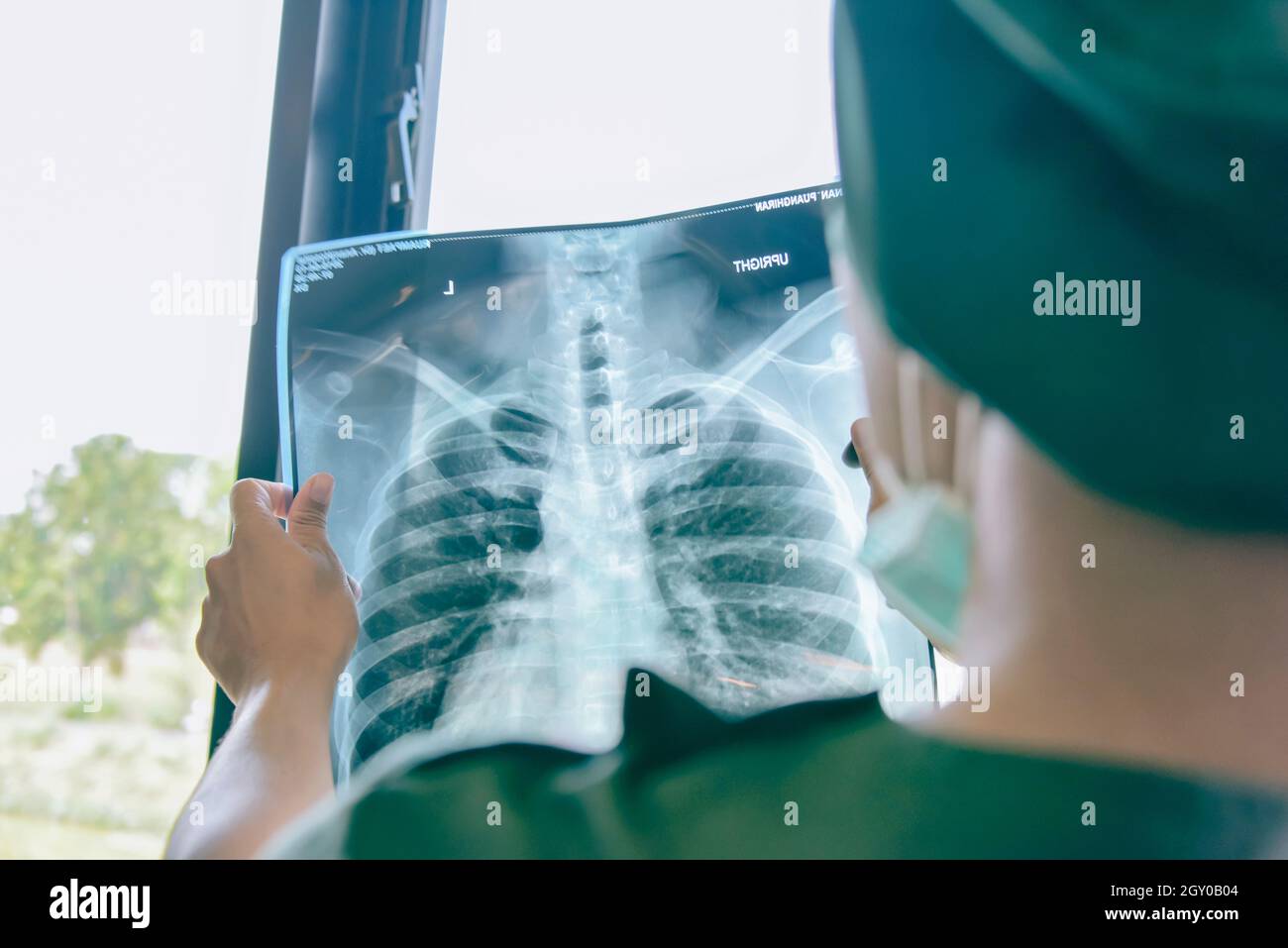 Doctor checking examining chest x-ray film of patient at ward hospital. Stock Photo