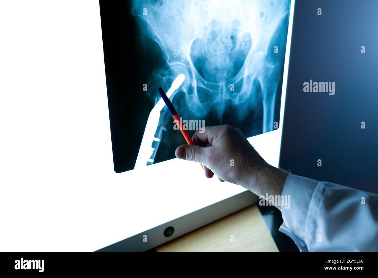 a radiologist examines an X-ray of the hip joint in close-up. Stock Photo
