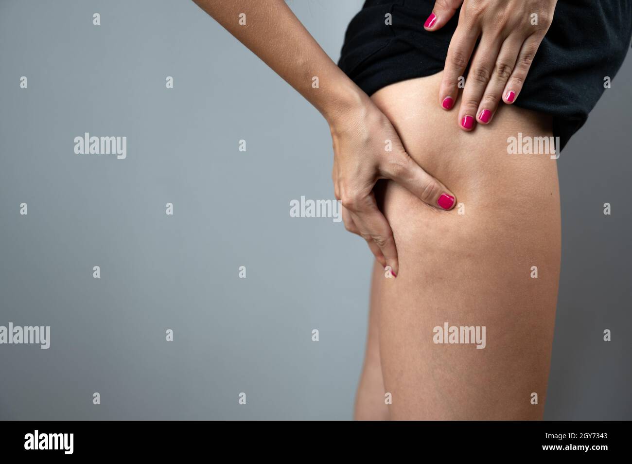 Woman squeezing her thigh to show cellulite on gray background with copy space Stock Photo Alamy