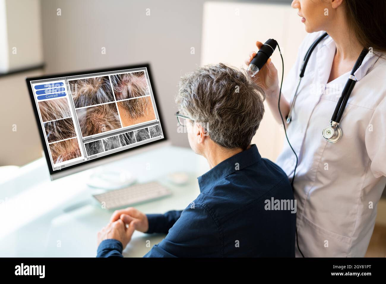 Hair Scalp Analysis In Clinic. Man With Hair Fall And Dandruff Stock