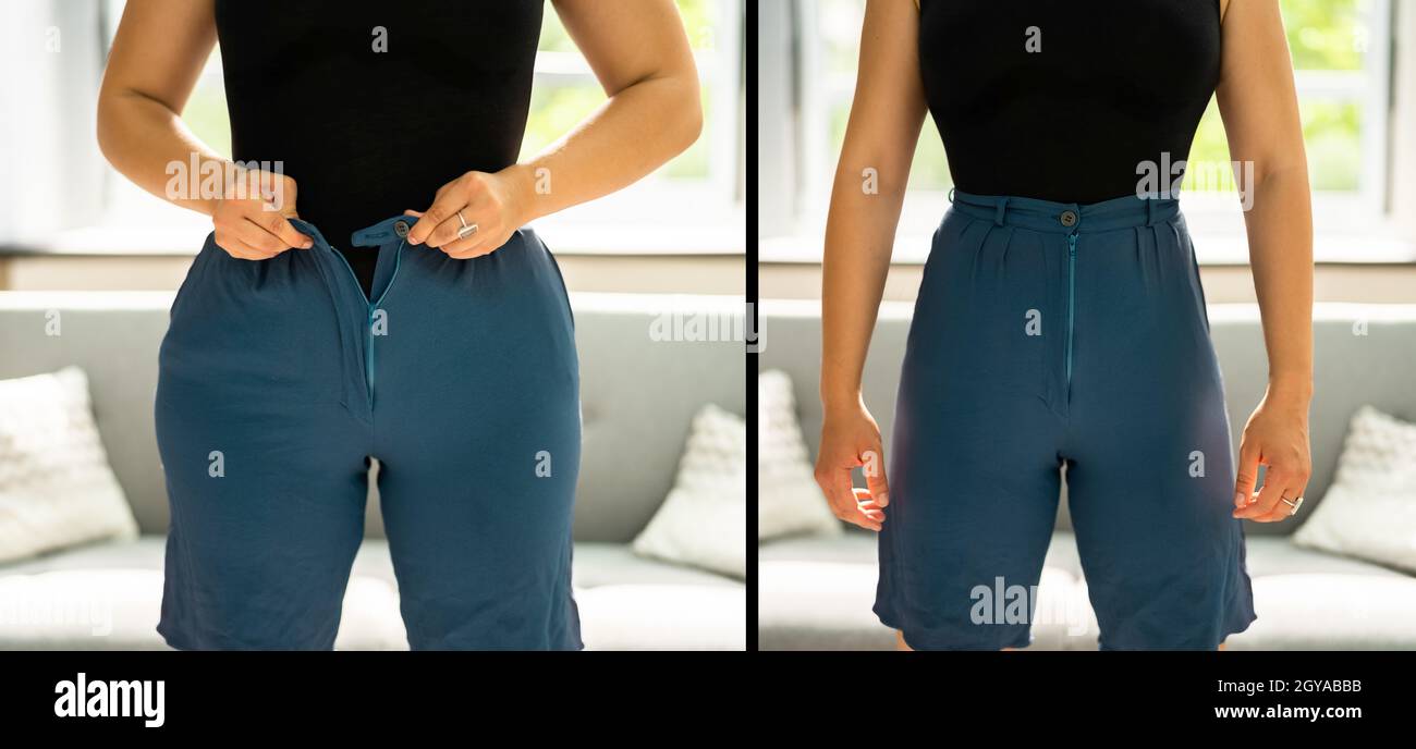 Before And After Weight Loss And Fat Loss Stock Photo - Alamy