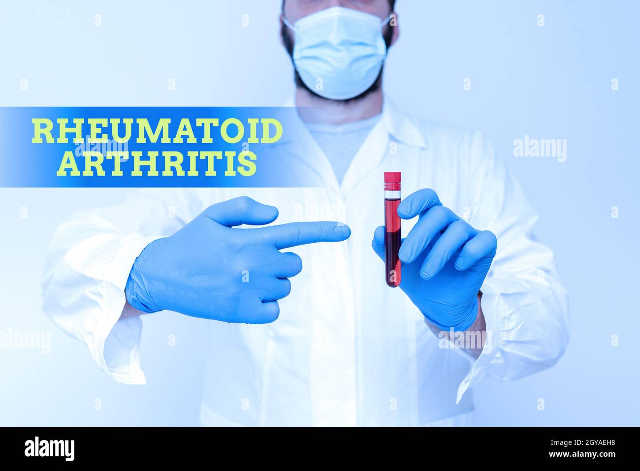 Inspiration showing sign Rheumatoid Arthritis, Concept meaning chronic