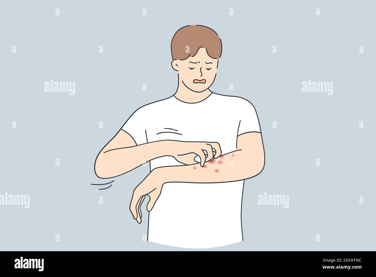 Skin allergy, Dermatitis, eczema concept. Annoyed young man in white t-shirt scratching itch on his arm feeling unhappy and uncomfortable vector illus Stock Photo
