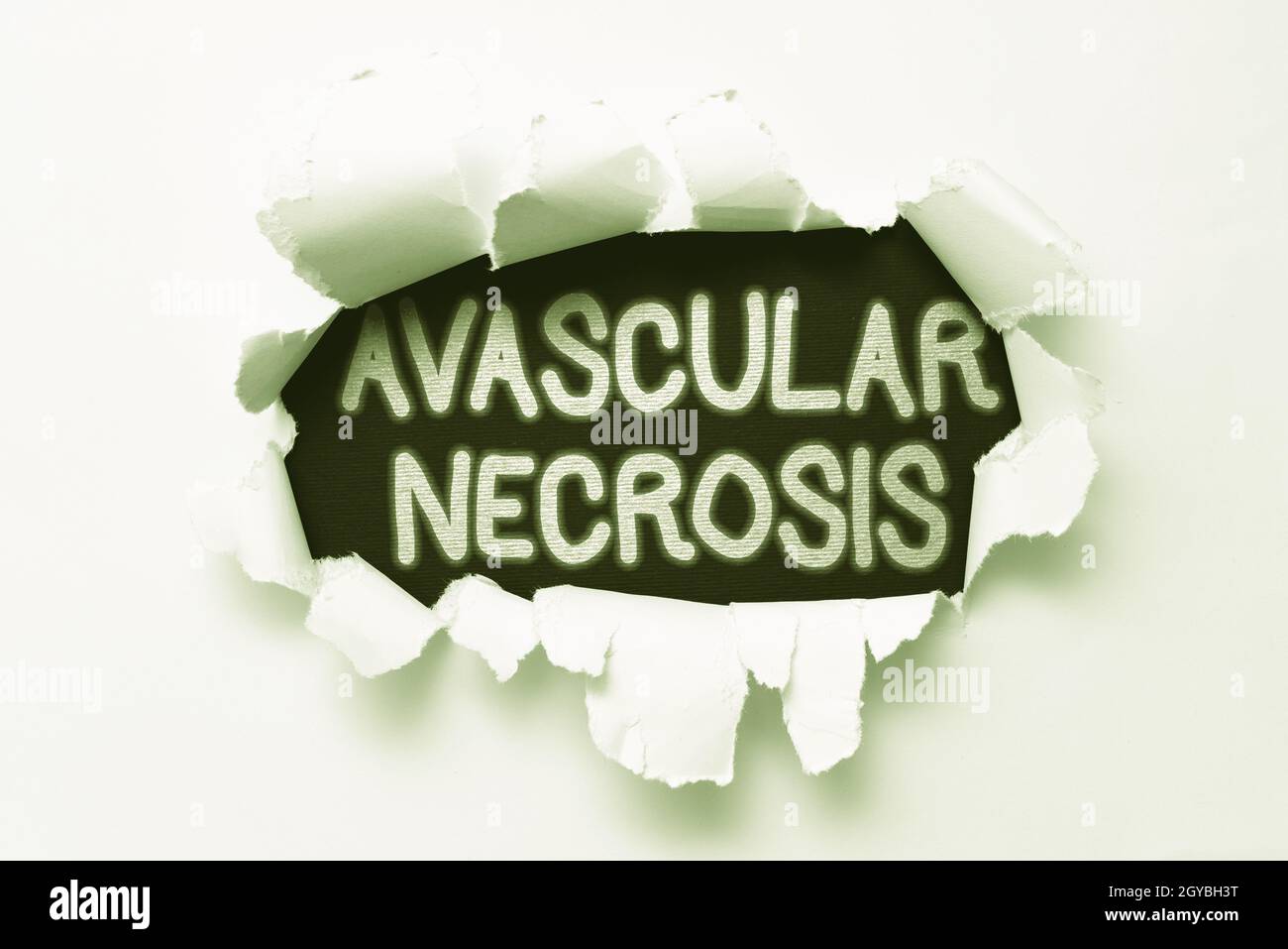 Text sign showing Avascular Necrosis, Concept meaning death of bone tissue due to a lack of blood supply Tear on sheet reveals background behind the f Stock Photo