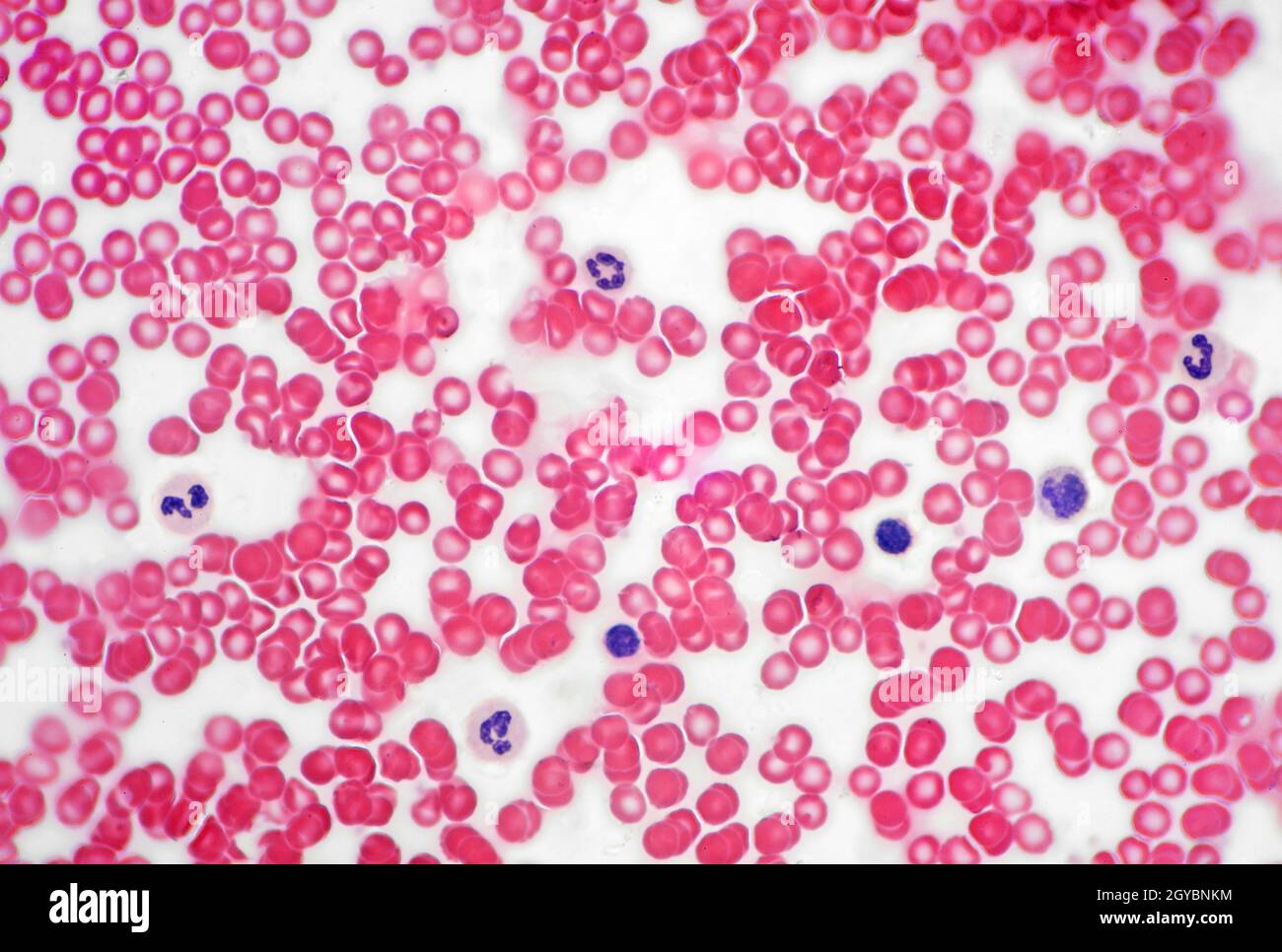 Human blood cells, stained brightfield photomicrograph Stock Photo