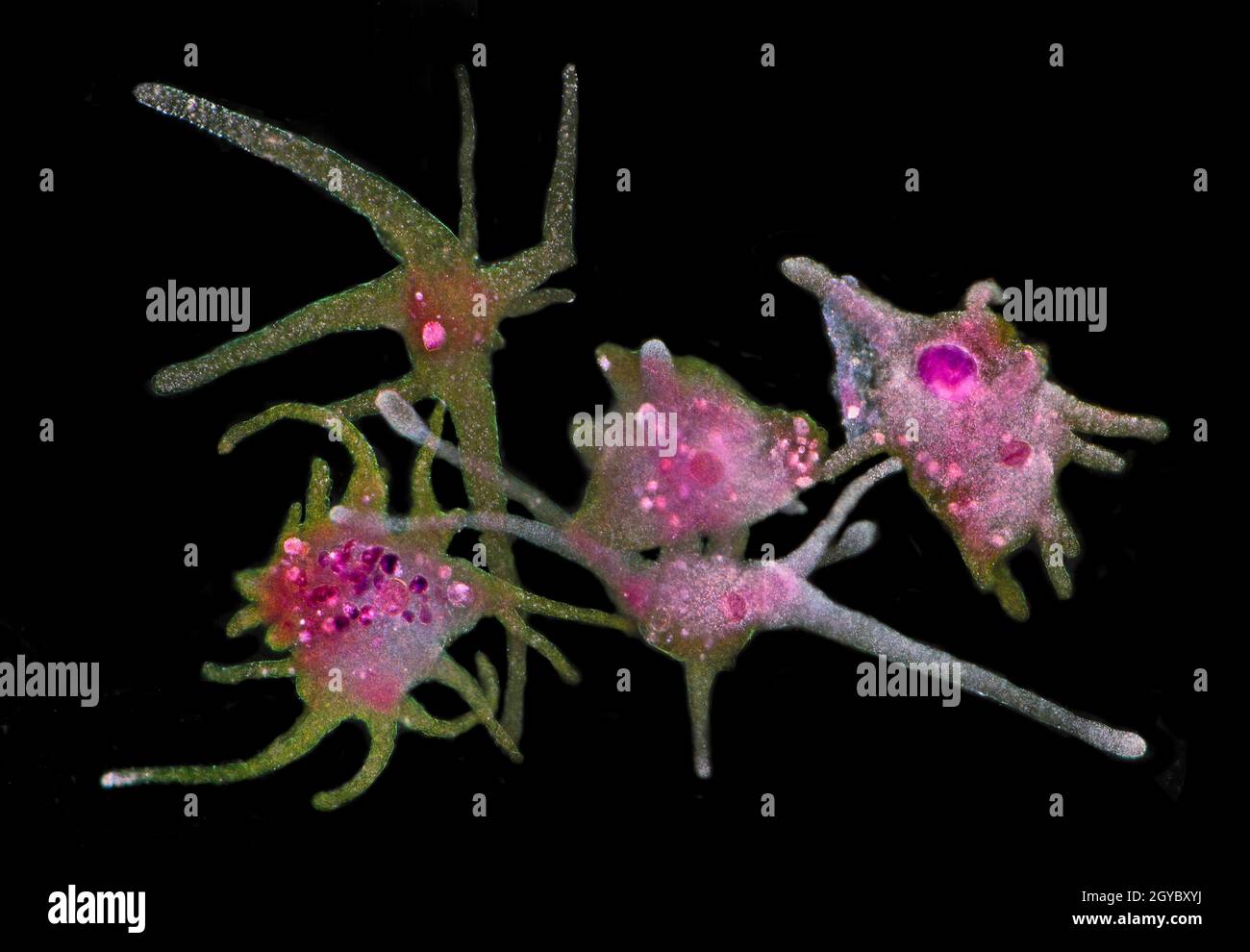Amoeba Proteus group, stained specimen, darkfield photomicrograph Stock Photo