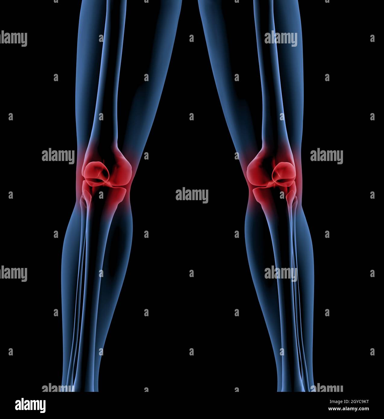Medical skeleton with a close up of the legs showing pain in the knees ...