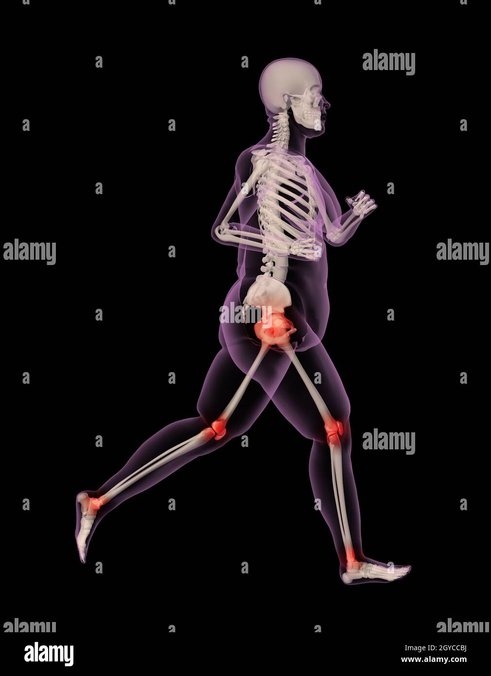 3D render of an overweight female skeleton running showing pressure