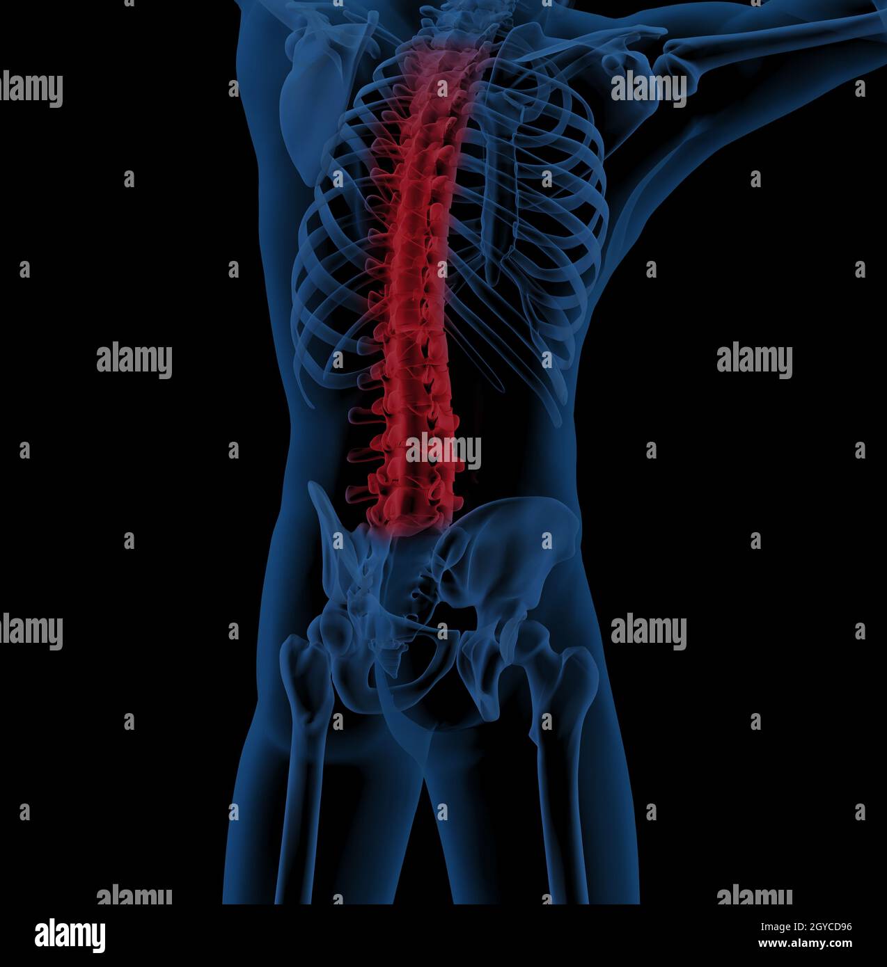 Back Problems Skeleton 3D render of a male medical skeleton with the spine highlighted ...