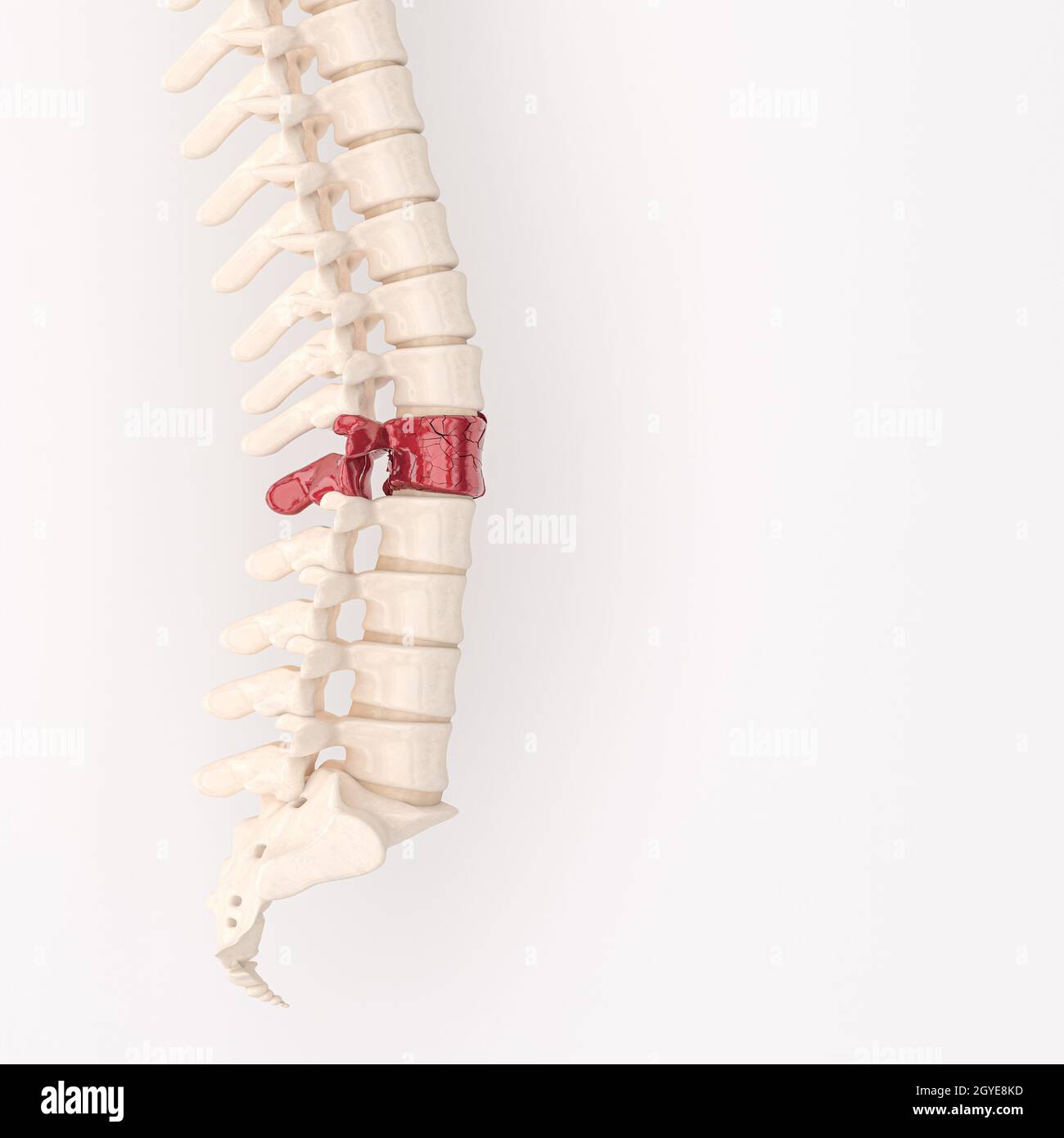backbone with red fragmented vertebrae. back problem concept. 3d render. Stock Photo