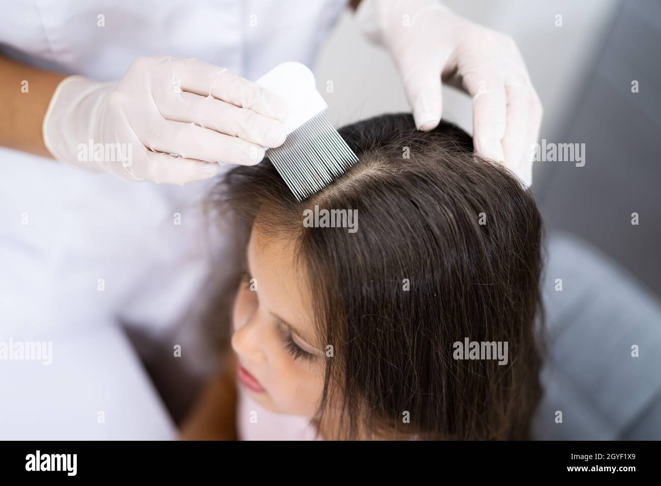Children with head lice hires stock photography and images Alamy