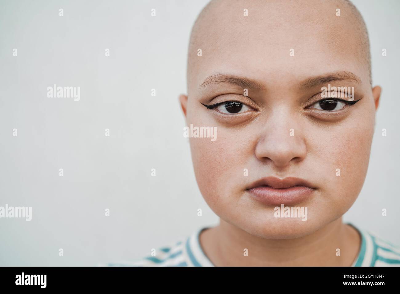 Bald girl posing in front of camera outdoor - Focus on eyes Stock Photo