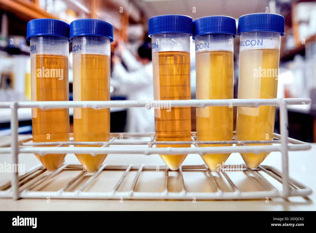 Vials of faecal extract in bowel cancer research laboratory. Stock Photo