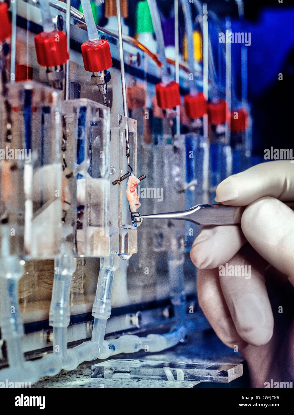 Automatic perfusion of a sample of human colon tissue. Stock Photo