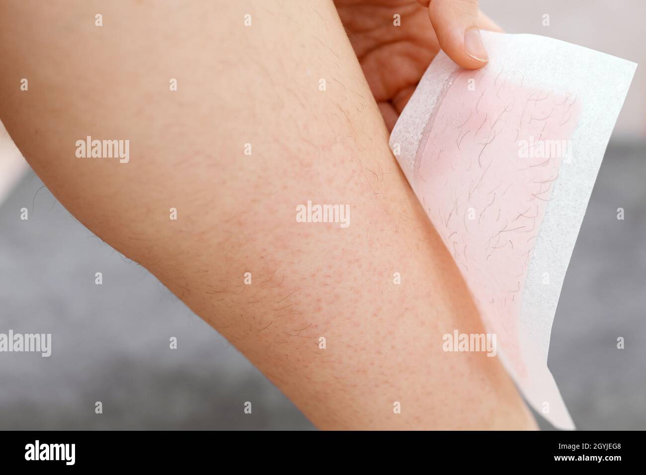 Hairy legs. Woman using beeswax stripe to shave her leg. Depilation procedure with wax, close up. Hair removal concept. Stock Photo