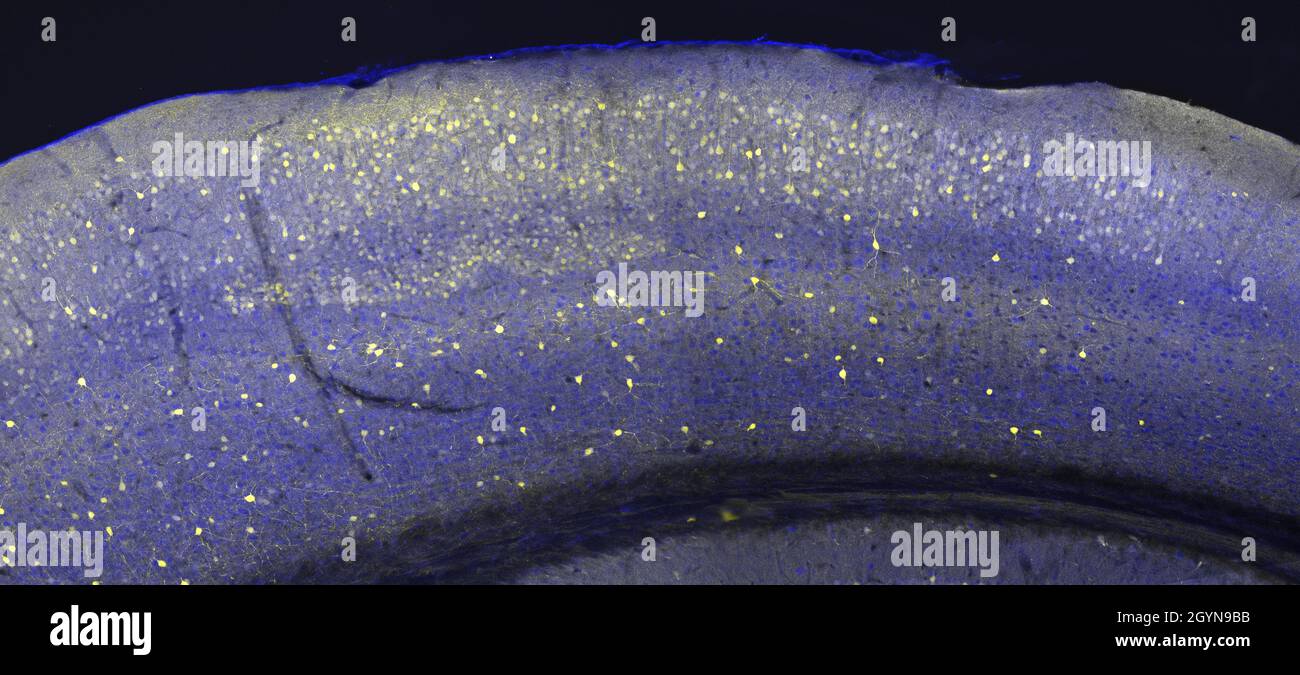 Cerebral cortex in a section of a mouse brain, labelled with immunofluorescence and recorded with confocal laser scanning microscopy Stock Photo