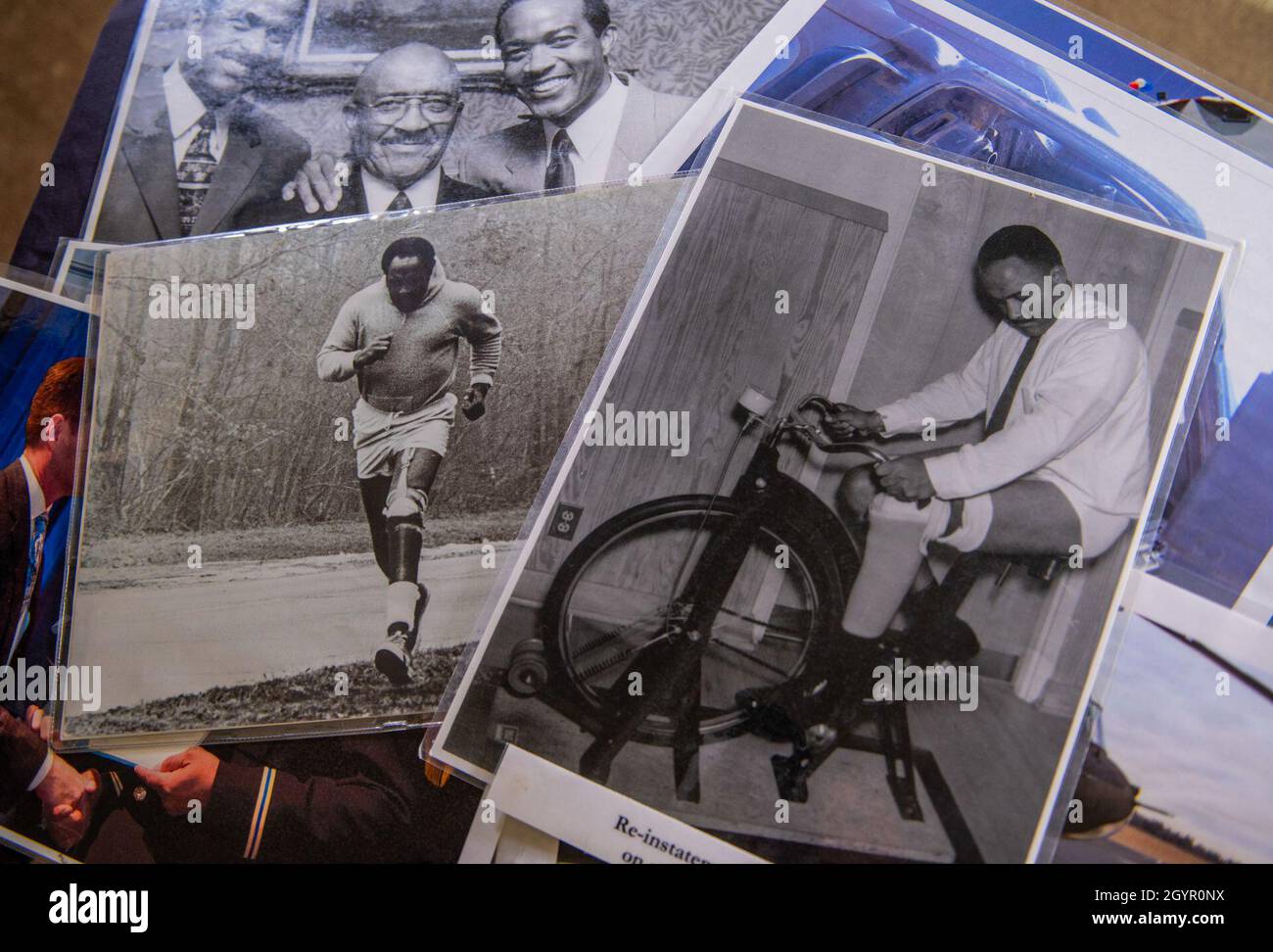 Various photographs depict Carl Brashear’s physical recovery after losing his leg in a diver