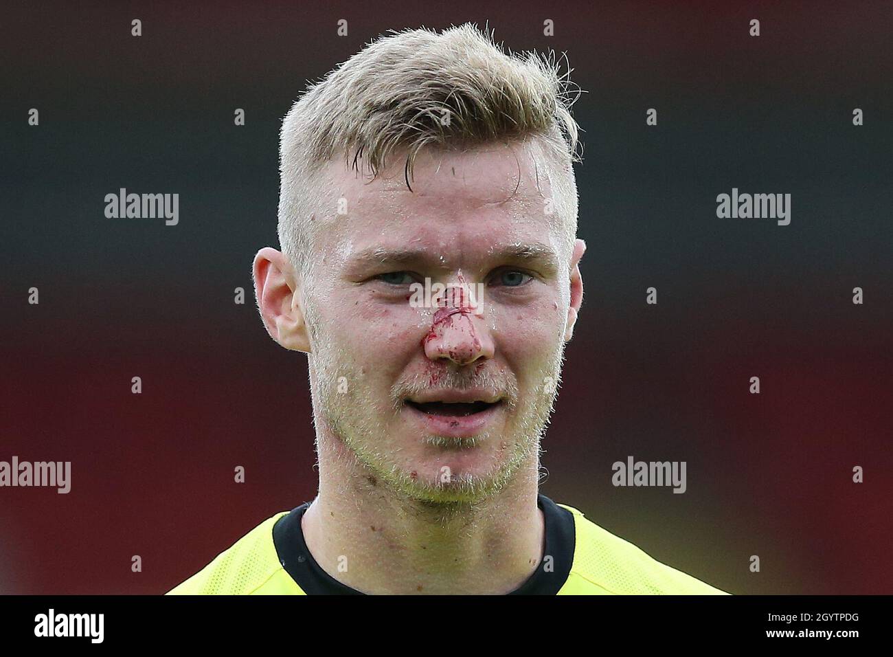 Brackley Town's Gareth Dean with an injured nose during the National League North match at Aggborough, Kidderminster. Picture date: Saturday October 9, 2021. Stock Photo