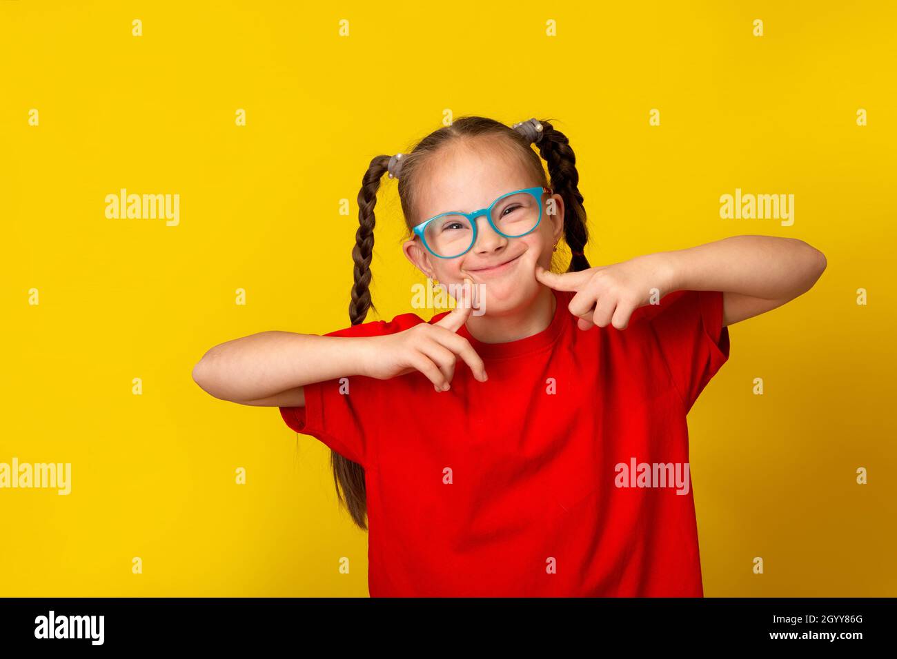 Happy girl with Down syndrome. Having fun, laughing. Funny pigtails. Studio. Portrait on a yellow background Stock Photo