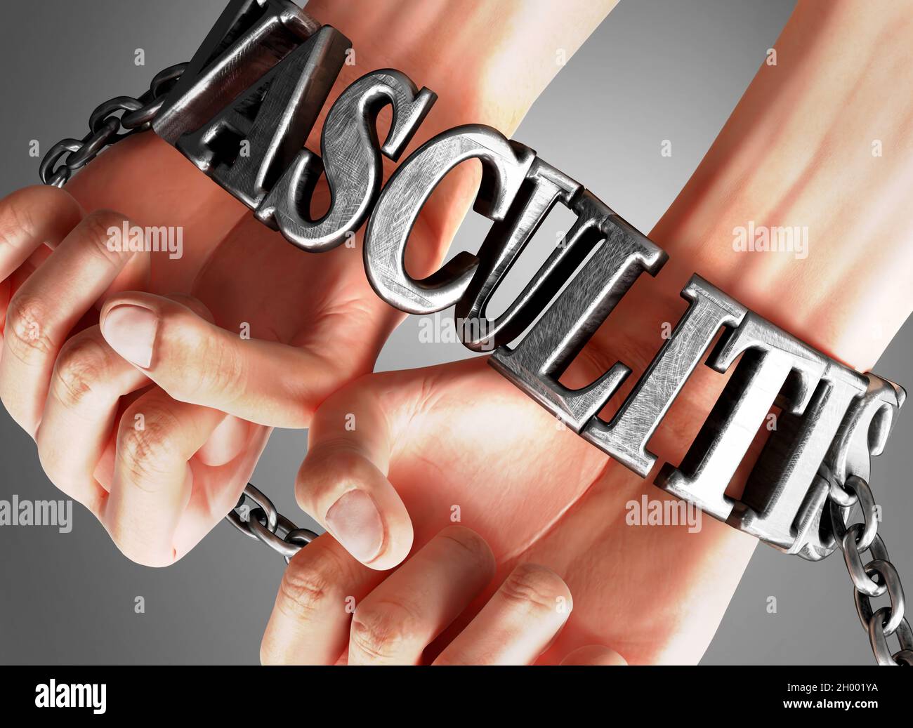 Vasculitis, social impact and its influence - a concept showing a person's hands in chains with a word Vasculitis as a symbol of its burden and misery Stock Photo