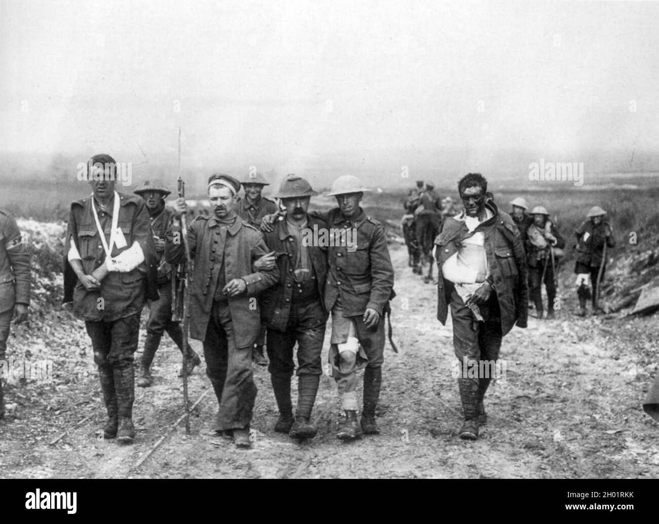 Walking wounded British soldiers return from the front lines. Stock Photo