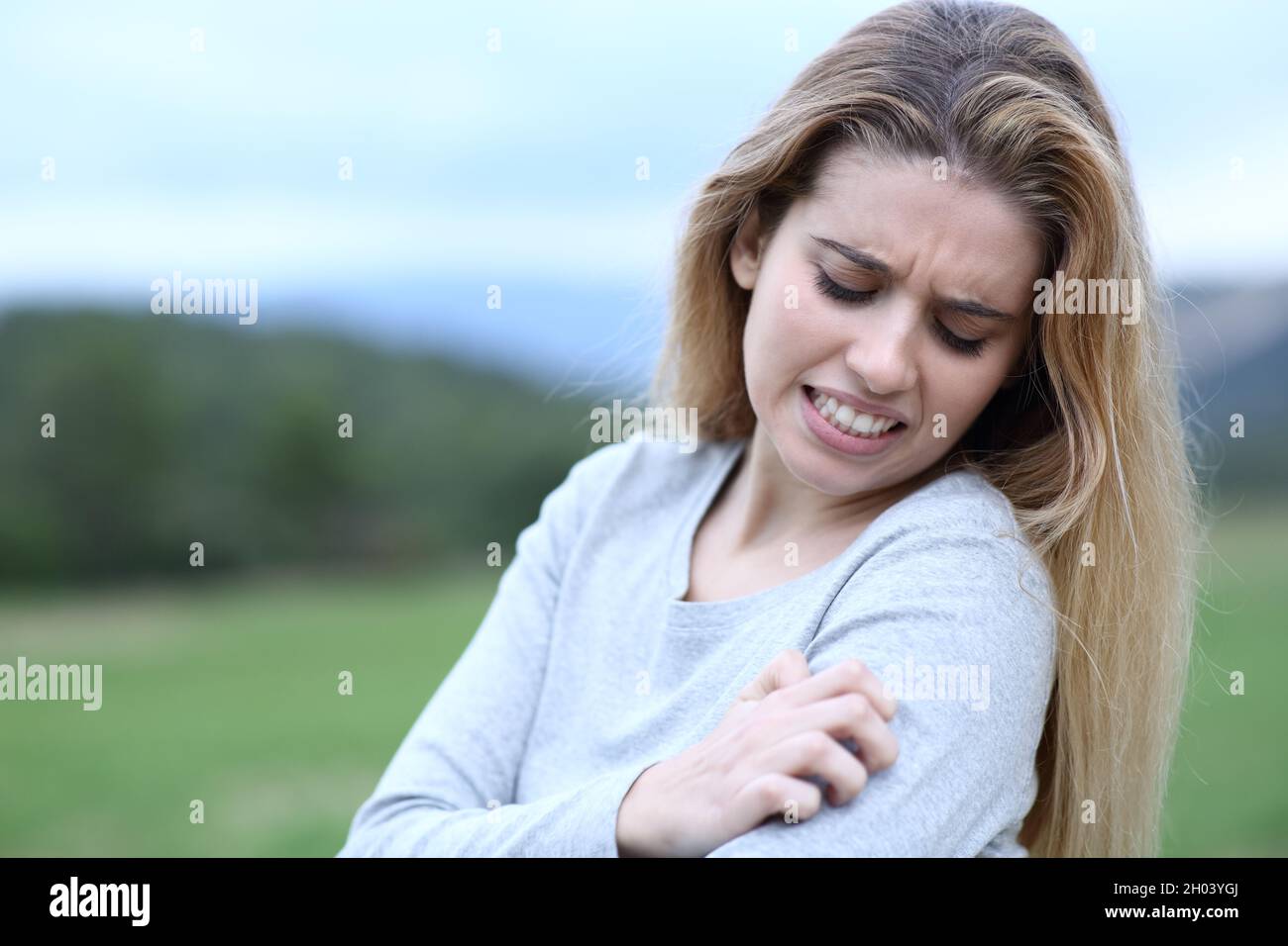 Stressed teen complaining scratching arm in a field Stock Photo