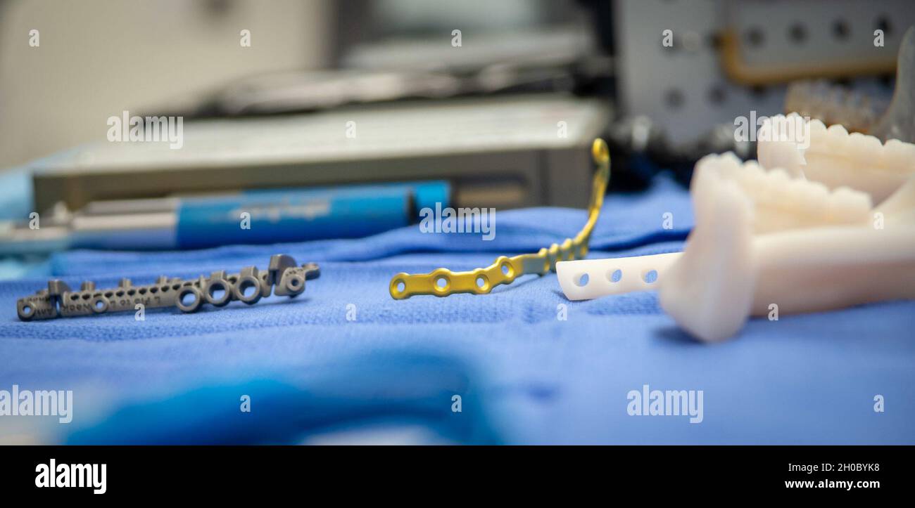 210120-N-DA693-1172  SAN DIEGO (Jan. 20, 2021) A detailed photo of a cutting guide, bone mounting hardware and a 3D-printed jaw mock up during an immediate jaw reconstruction with 3D-printed teeth in one of Naval Medical Center San Diego’s (NMCSD) operating rooms Jan. 20. The procedure was performed by teams from the hospital’s Oral and Maxillofacial Surgery, Plastic Surgery and Otolaryngology Departments. The surgery comprised of not only cancer removal, but the reconstruction of a jaw using a section of the patient’s fibula, the smaller of the two lower leg bones. The COVID-19 pandemic has c Stock Photo