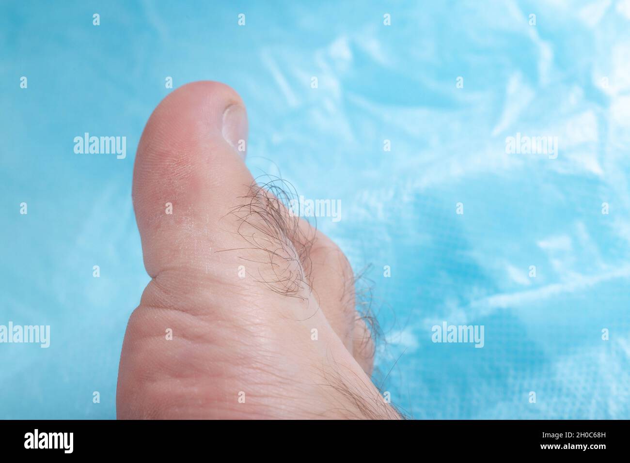Toe hair on a blue background, copy space for text. Hair removal from