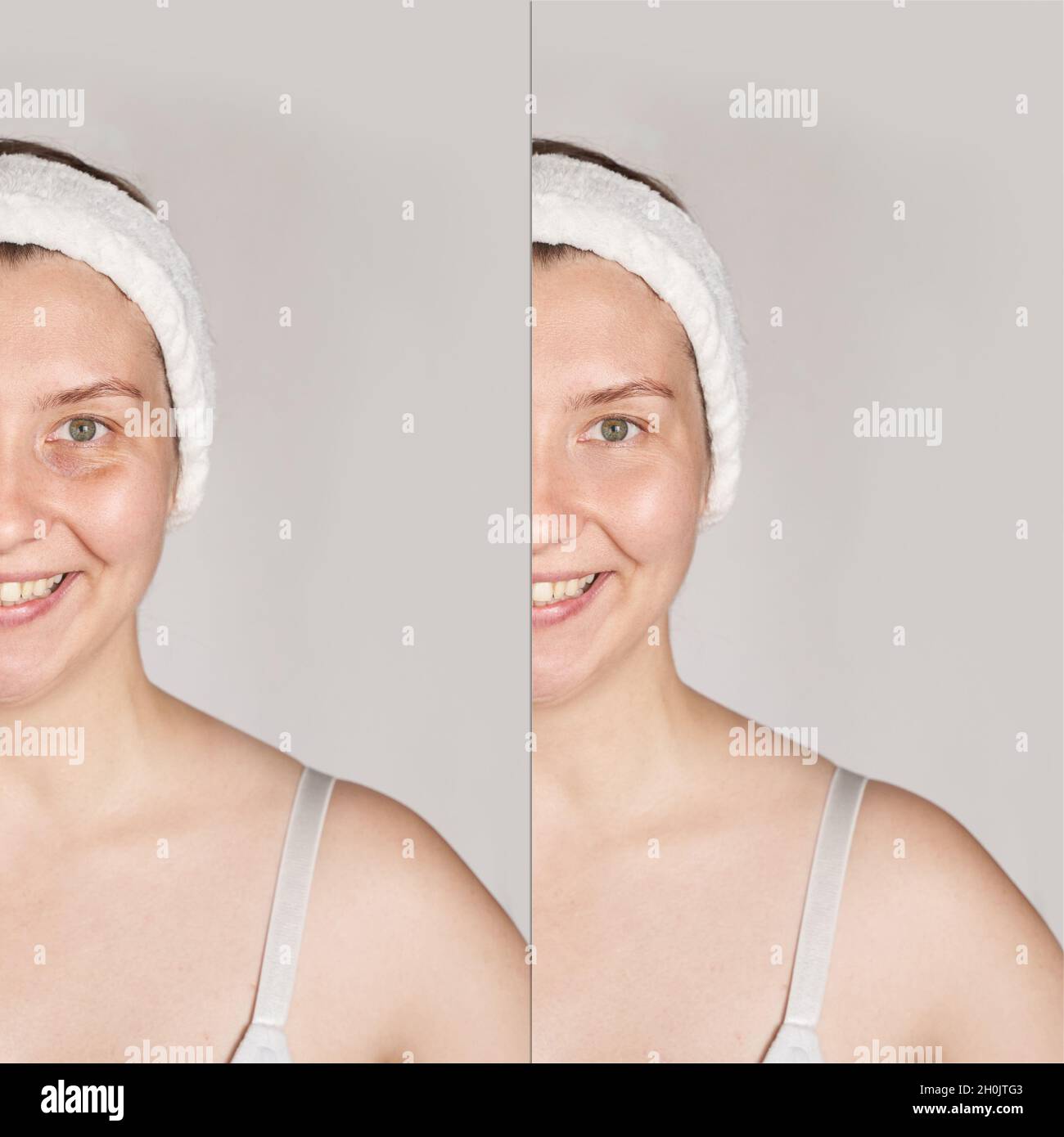 glutathione antes y después List of FDA Approved Collagen Supplements in the Philippines 2025 main image 0